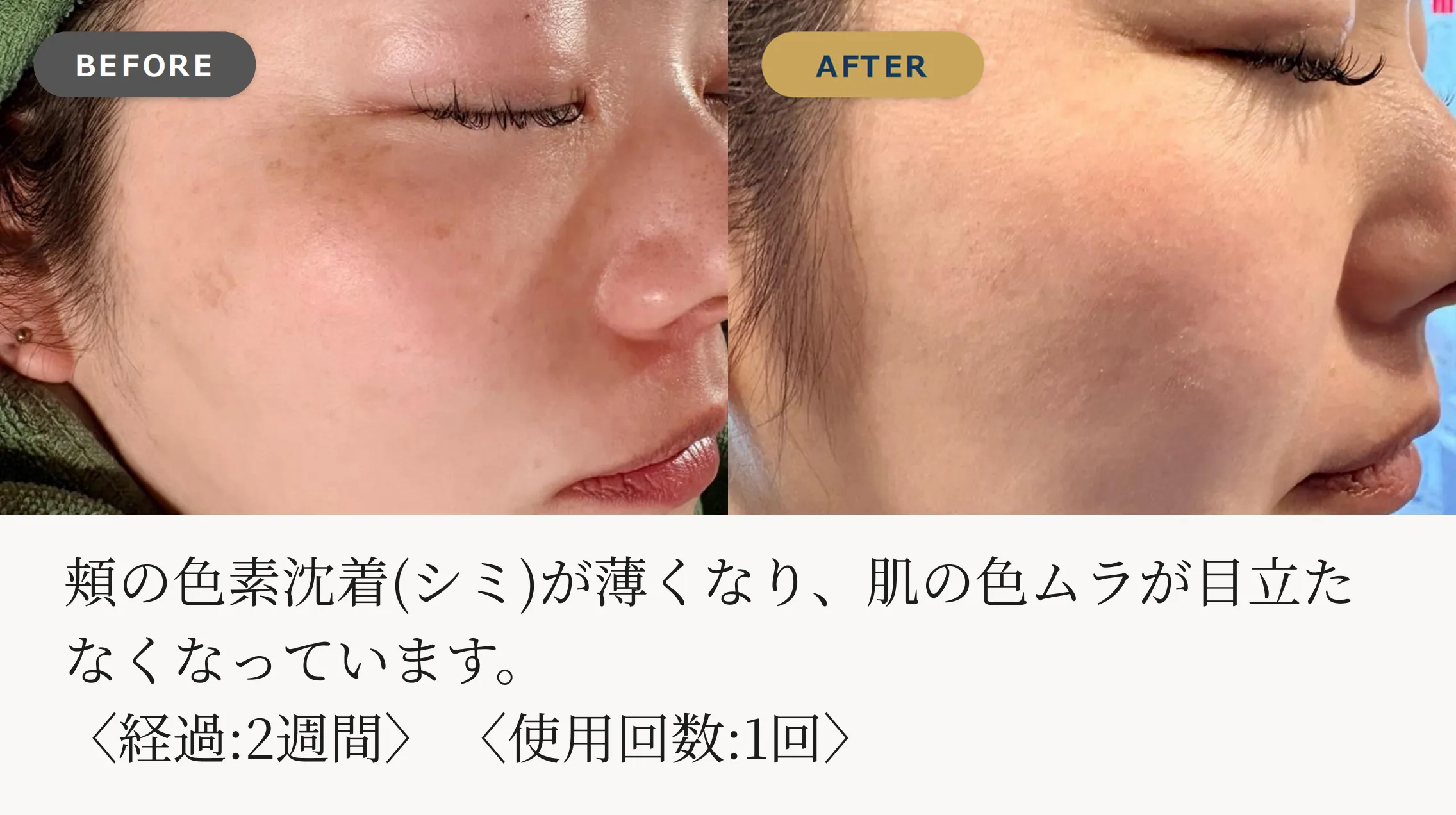 フェイシャルケアの施術イメージ
